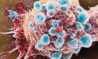 دستاورد محققان تبریز برای افزایش کارایی شیمی‌درمانی سرطان پستان