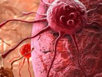 کشف ژن افزایش‌دهنده خطر ابتلا به سرطان پروستات
