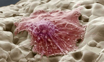 موفقیت محققان دانشگاهی در تخریب سلول‌های سرطانی با امواج فراصوت