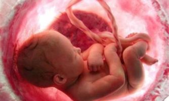 شناسایی ناهنجاری‌های کروموزومی کوچک جنین با تکنیک نوین محققان ایرانی
