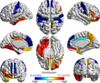 پیش‌بینی احتمال اعتیاد در نوجوانان با اسکن مغزی
