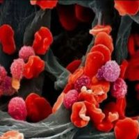 موفقیت محققان ایرانی در درمان فتودینامیکی سلول‌های سرطانی
