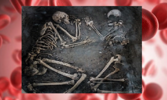 «کمبود آهن» در «عصر آهن»/یافته‌های دیرین آسیب شناسی اجساد گورستان‌های باستانی سمنان