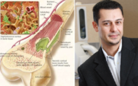 ابداع ترکیب دارویی درمان عفونت استخوانی توسط دانشمند ایرانی