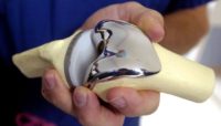 ساخت پروتز مفصل زانوی معلولان سنگین وزن توسط پژوهشگران «شریف»