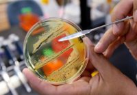 جایزه ۷۰ میلیون تومانی برای برنده چالش ساخت «نانوحسگر باکتری مرگبار بوتولونیوم»