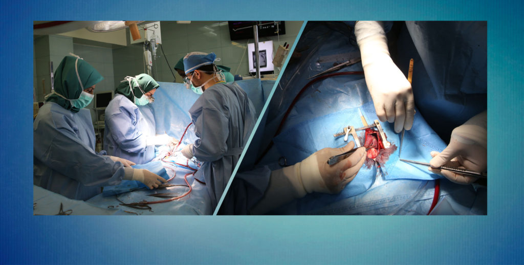 جراحی پیچیده اصلاح کامل تترالوژی فالوت قلب با موفقیت در کشور انجام شد