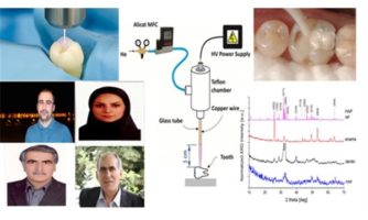 در مرکز تحقیقات فیزیک پلاسما دانشگاه آزاد محقق شد: اتصال بهتر کامپوزیت به دندان با پلاسماجت