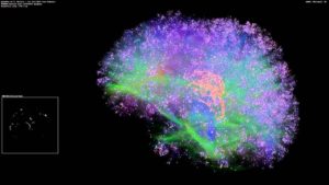 پیشگیری و درمان بیماری‌های مغزی با مدل سازی شبکه های مغز