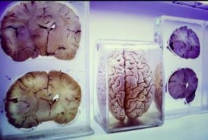 سال آینده گشوده می شود: «موزه مغز»، فصلی تازه در «باغ کتاب تهران»