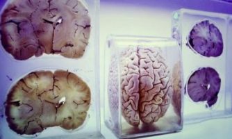 روش‌های تحریک عمقی مغز، موضوع مدرسه تابستانه آزمایشگاه ملی مغز