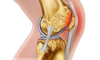 ترمیم ضایعات غضروفی با ریزساختارهای ماتریکس خارج سلولی بر اساس یافته های محققان رویان اصفهان