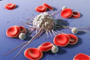 تشخیص برخی از سرطان ها با آزمایش خون