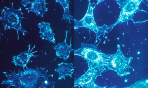 محققان ایرانی سلول های سرطانی را در جریان دارورسانی، تعقیب تصویری کردند