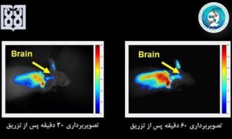 در دانشگاه علوم پزشکی تهران محقق شد: ردیابی مسیر دارورسانی به مغز با تصویربرداری اپتیکی