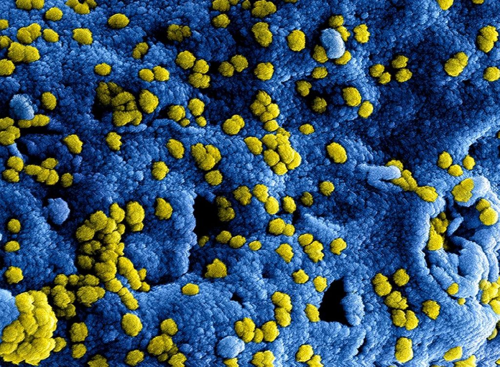 کارایی احتمالی داروی ابولا و سارس در مقابله با کروناویروس جدید