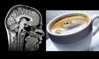 افزایش خطر زوال عقل با نوشیدن بیش از شش فنجان قهوه در روز