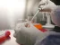 موفقیت محققان ایرانی در تولید محصولی بیولوژیک برای رفع نارسایی زودرس تخمدان