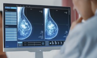 ساخت سامانه کمک تشخیصی سرطان پستان با استفاده از هوش مصنوعی در کشور