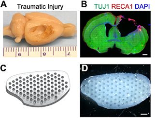 استفاده از چاپ سه‌ تا شش بعدی در درمان سرطان مغز و مهندسی بافت عصبی