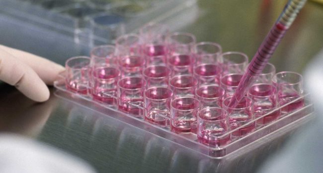 تامین نیاز آزمایشگاه‌ها با کیت‌های تشخیصی سلولی و مولکولی ایران‌ساخت