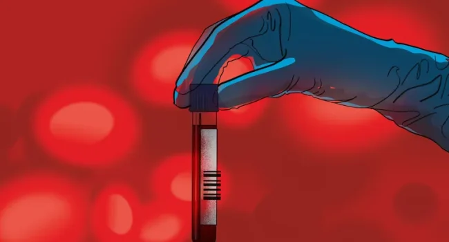 استفاده از سلول‌های بنیادی خون قاعدگی در درمان اختلالات تولید مثل/افت شدید تعداد،کیفیت و تحرک اسپرم‌ها در مردان ایرانی