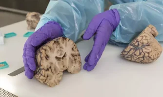 بیوبانک بافت مغز