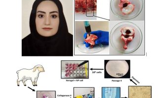 ساخت هیدروژل تزریقی خودترمیم‌شونده برای درمان دیسک بین‌مهره‌ای
