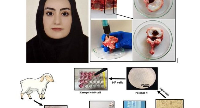 ساخت هیدروژل تزریقی خودترمیم‌شونده برای درمان دیسک بین‌مهره‌ای